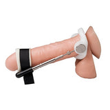 jes-extender-gold-standard